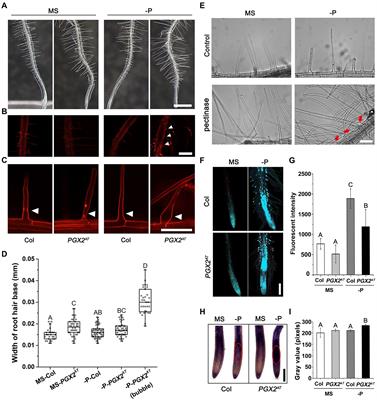 The Root Hair Development of Pectin Polygalacturonase PGX2 Activation Tagging Line in Response to Phosphate Deficiency